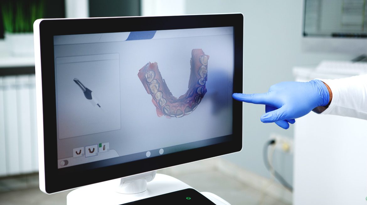 Invisalign 101 – Most Common Questions Answered