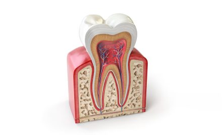 Everything you wanted to know about root canal treatment